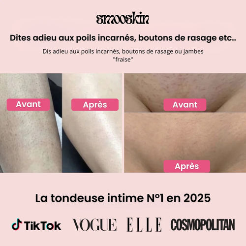 Tondeuse Intime Smooskin™